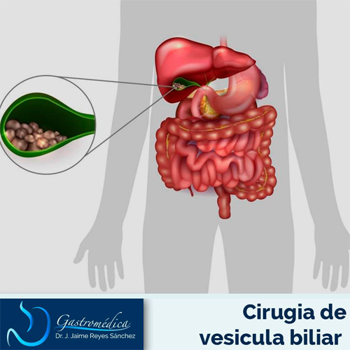 Vesícula Biliar y Vías Biliares