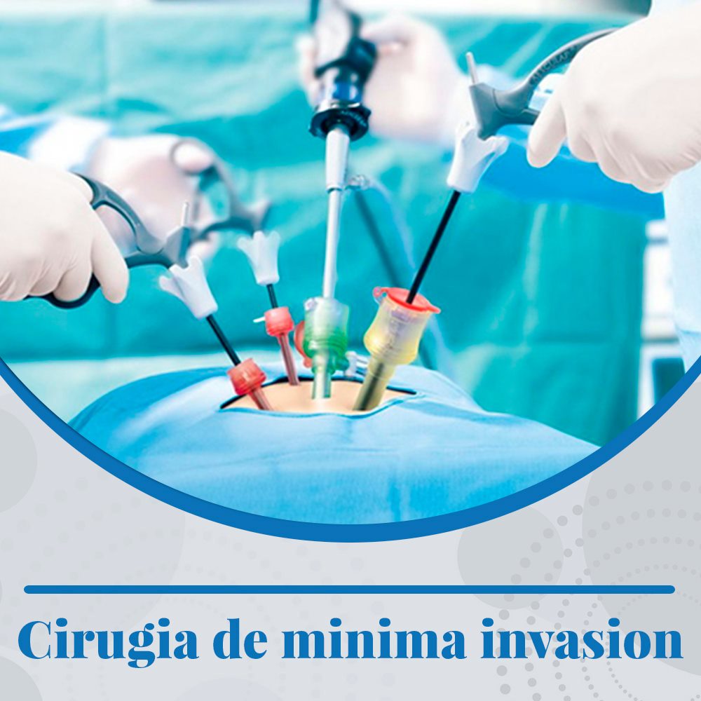 Cirugía ginecológica de minima invasión