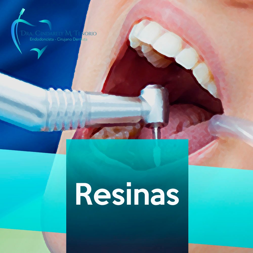 Amalgama y resinas dentales