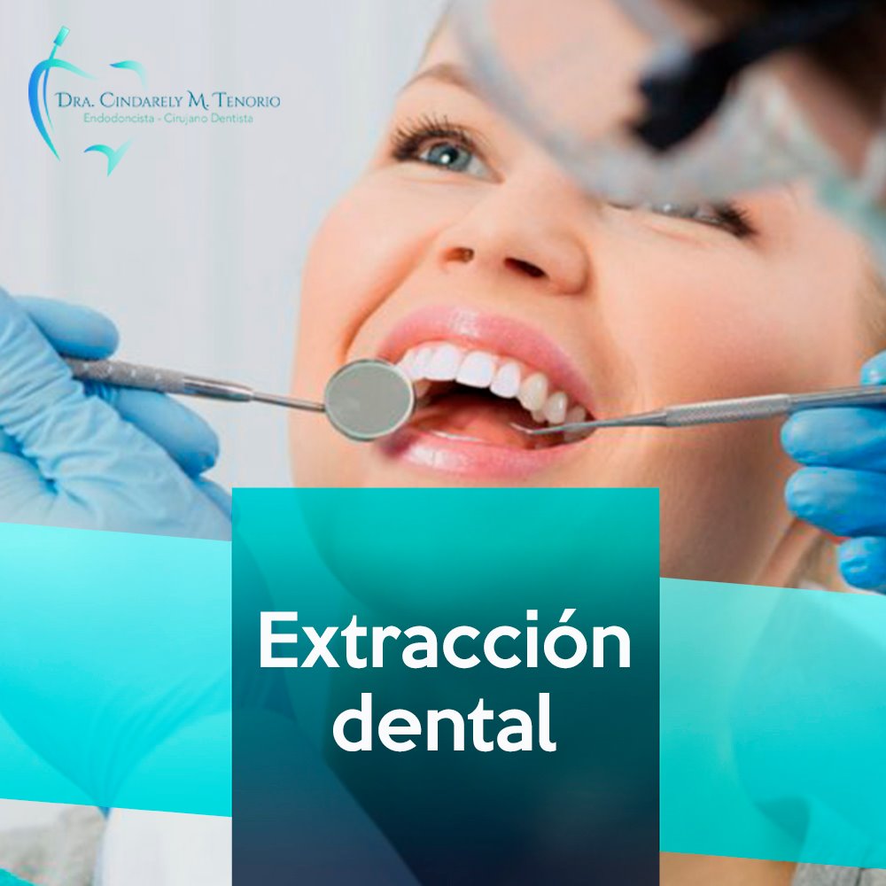 Extracción dental