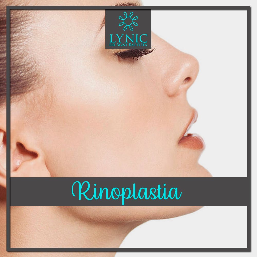 Rinoplastia