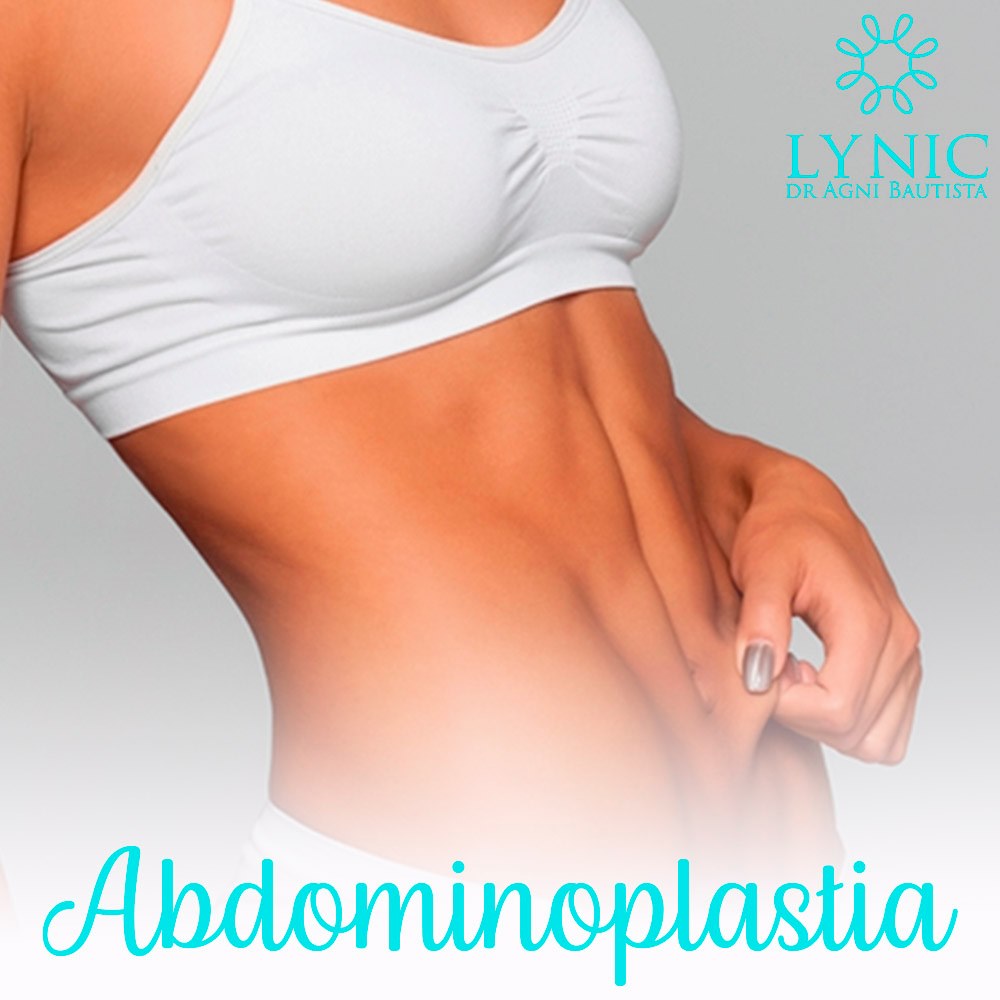 Abdominoplastia