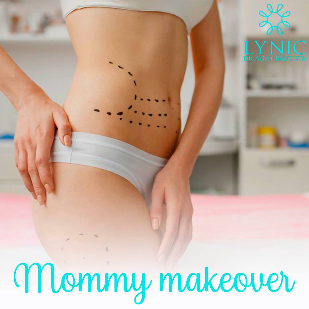 Mommy makeover. 