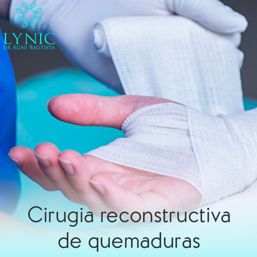 Atención a paciente quemado